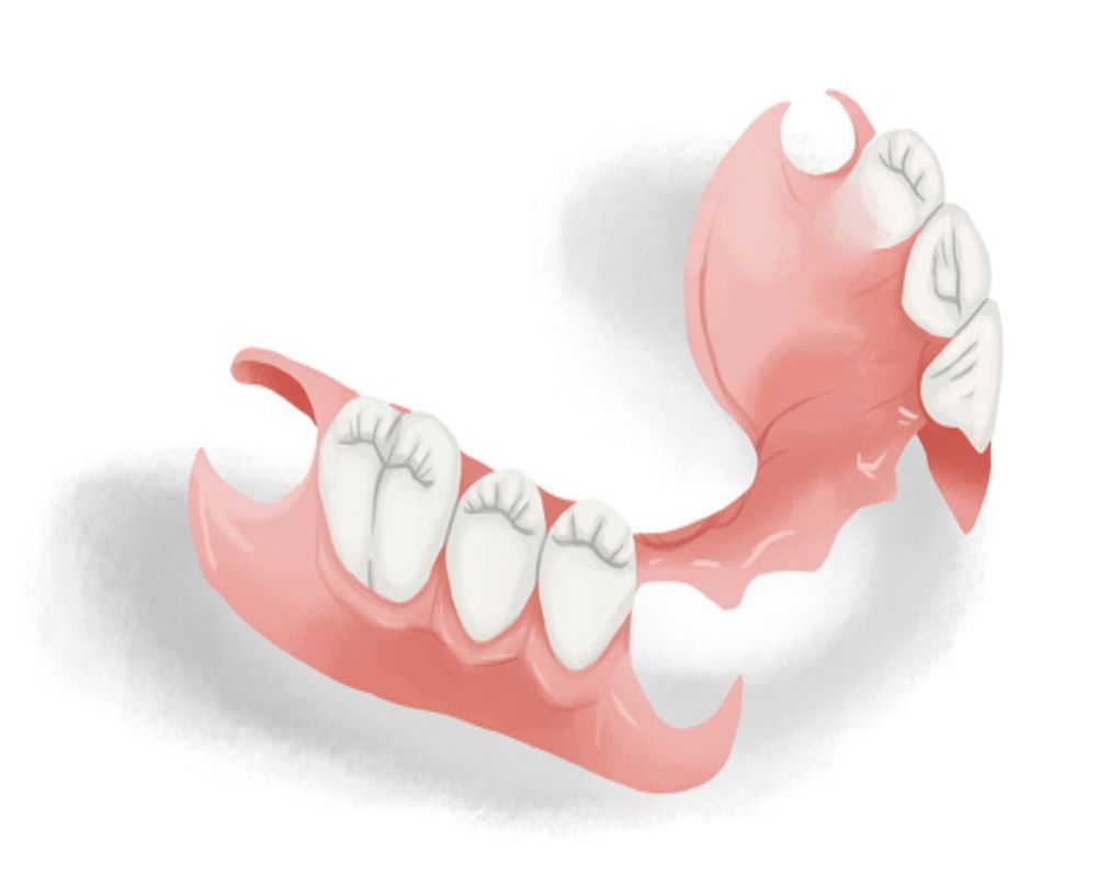 removal_dentures